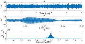 Radio Interference